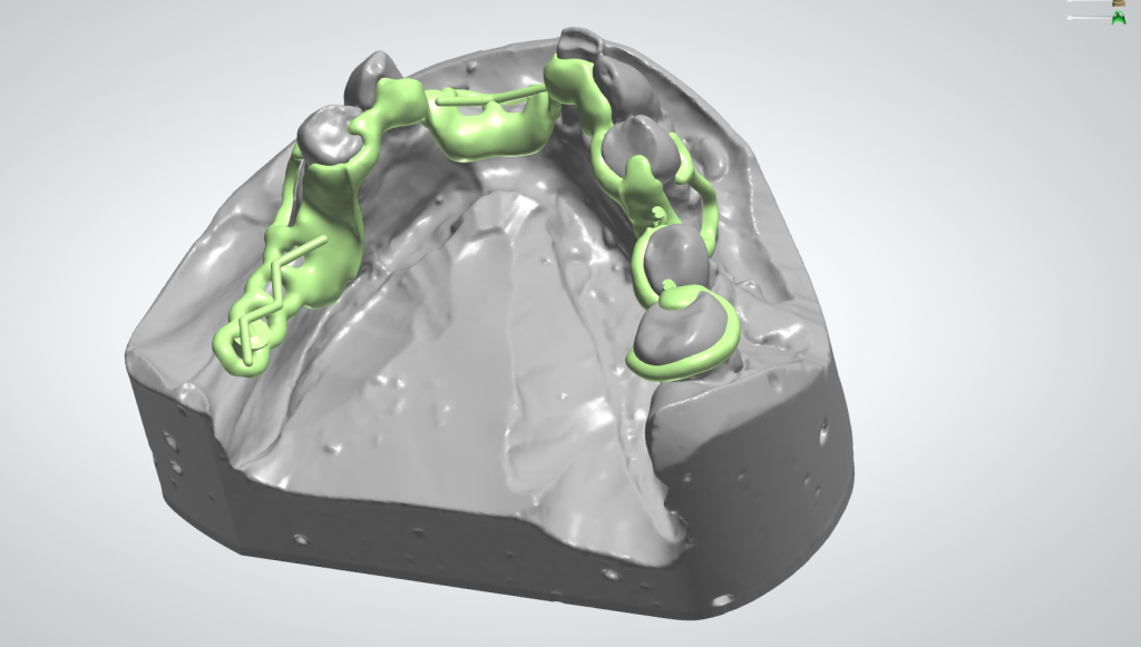 Chrome Rpd Alternative chrome frame design - Hughes Dental Laboratory